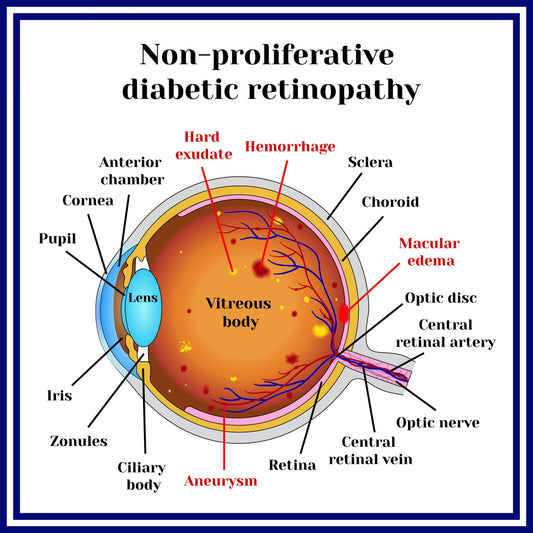 What is The Clinical Classification of Diabetic Retinopathy?