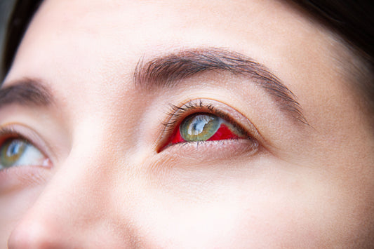 What is Diabetic Retinopathy?